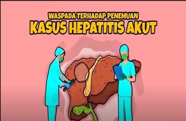 hepatitis akut